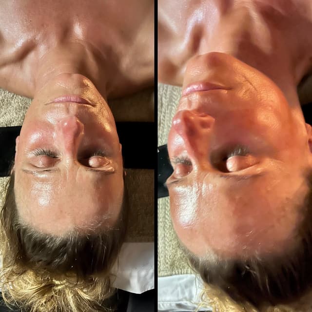 Custom glow peel series at Glow Beauty Bar in Manitowoc, WI